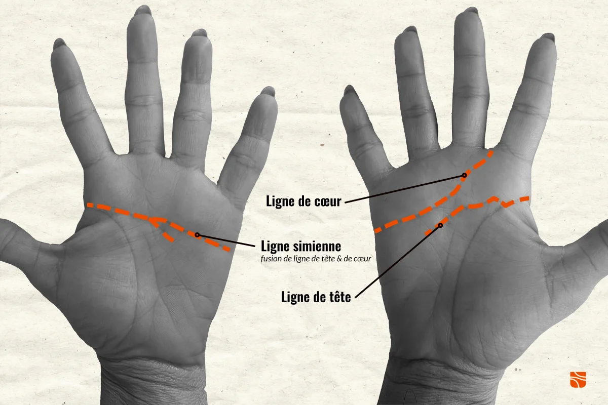 comparatif ligne simienne ligne de tête et ligne de cœur