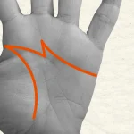 signe M dans la paume de la main