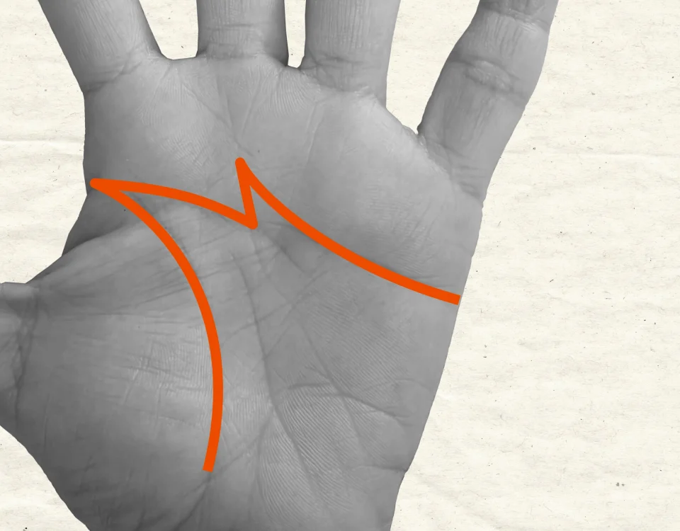 signe M dans la paume de la main